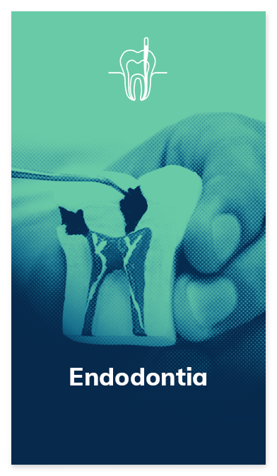 card-endodontia-oral-dente