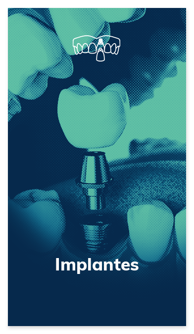 card-implante-oral-dente