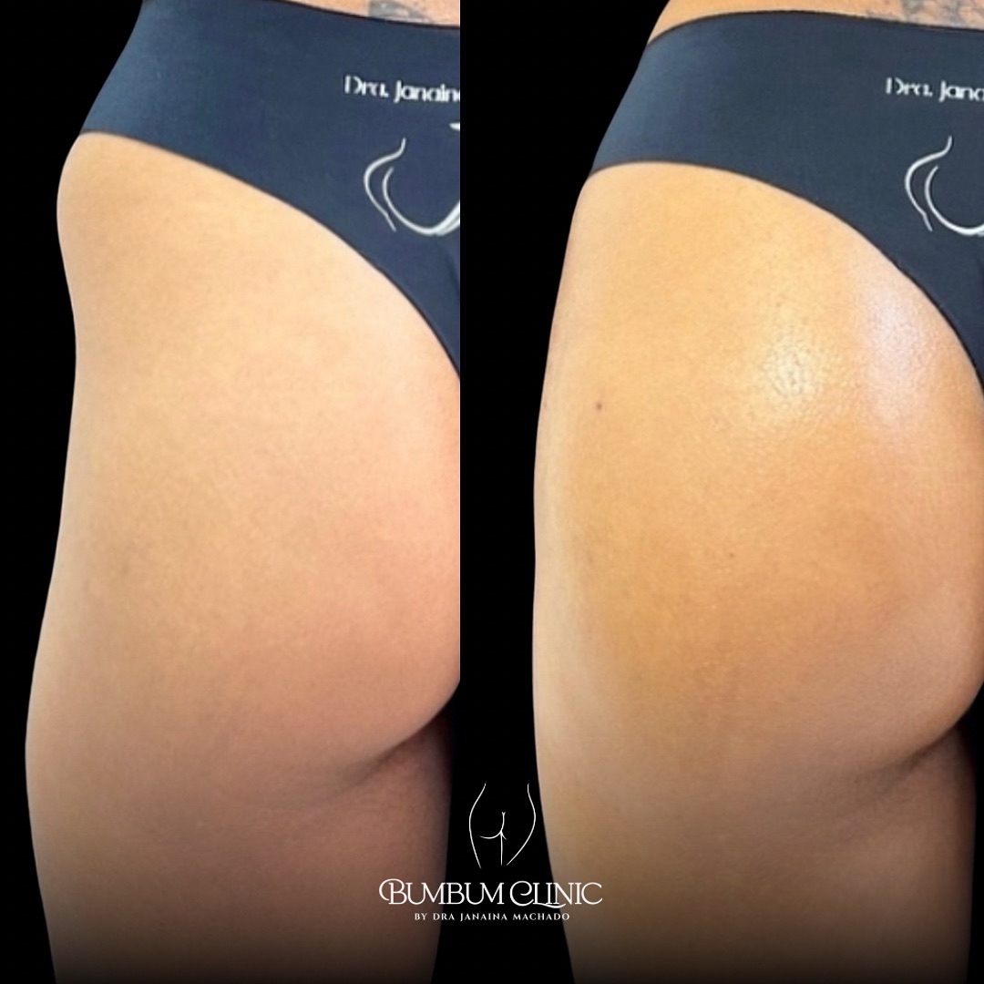 Snapinsta.app_469417356_1096005378567392_4713340794829684271_n_1080