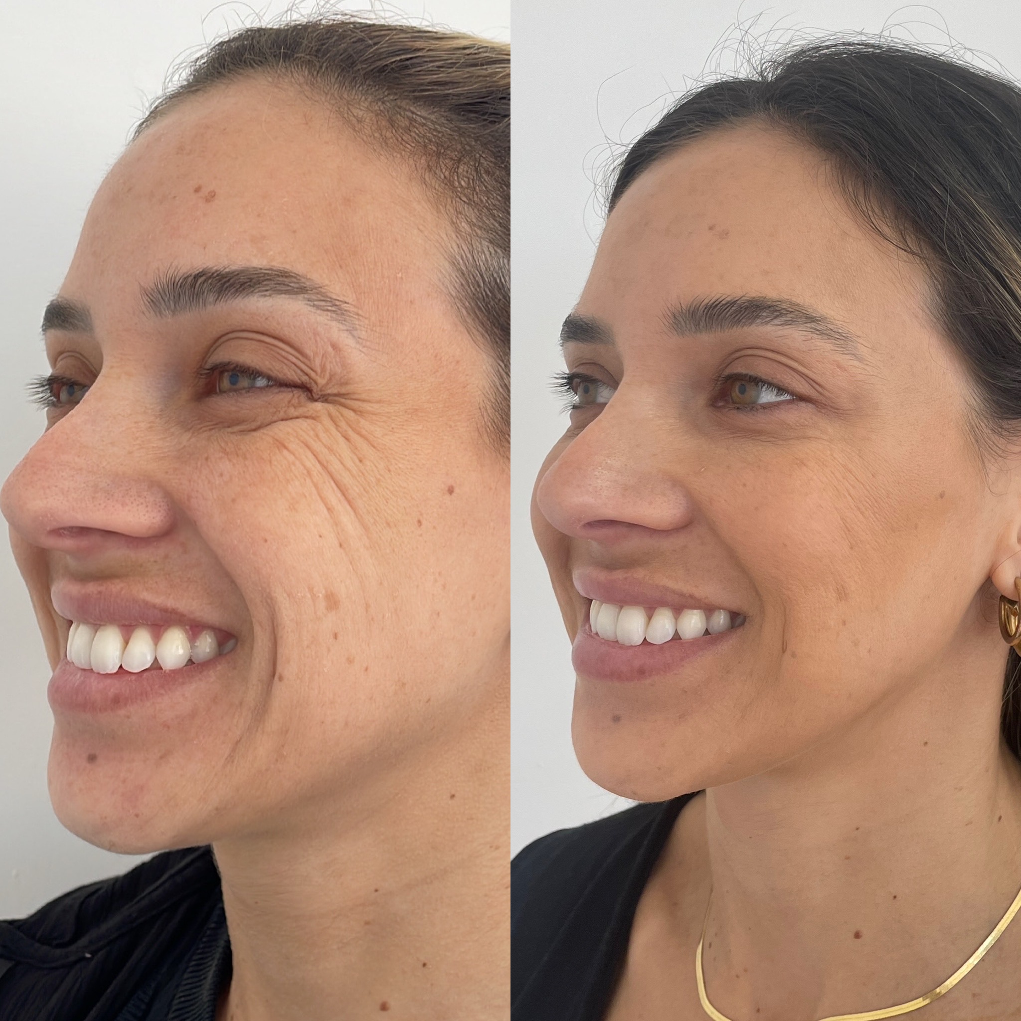 F00CB39E-DCBF-43A7-A6F9-4CD33C8348E9