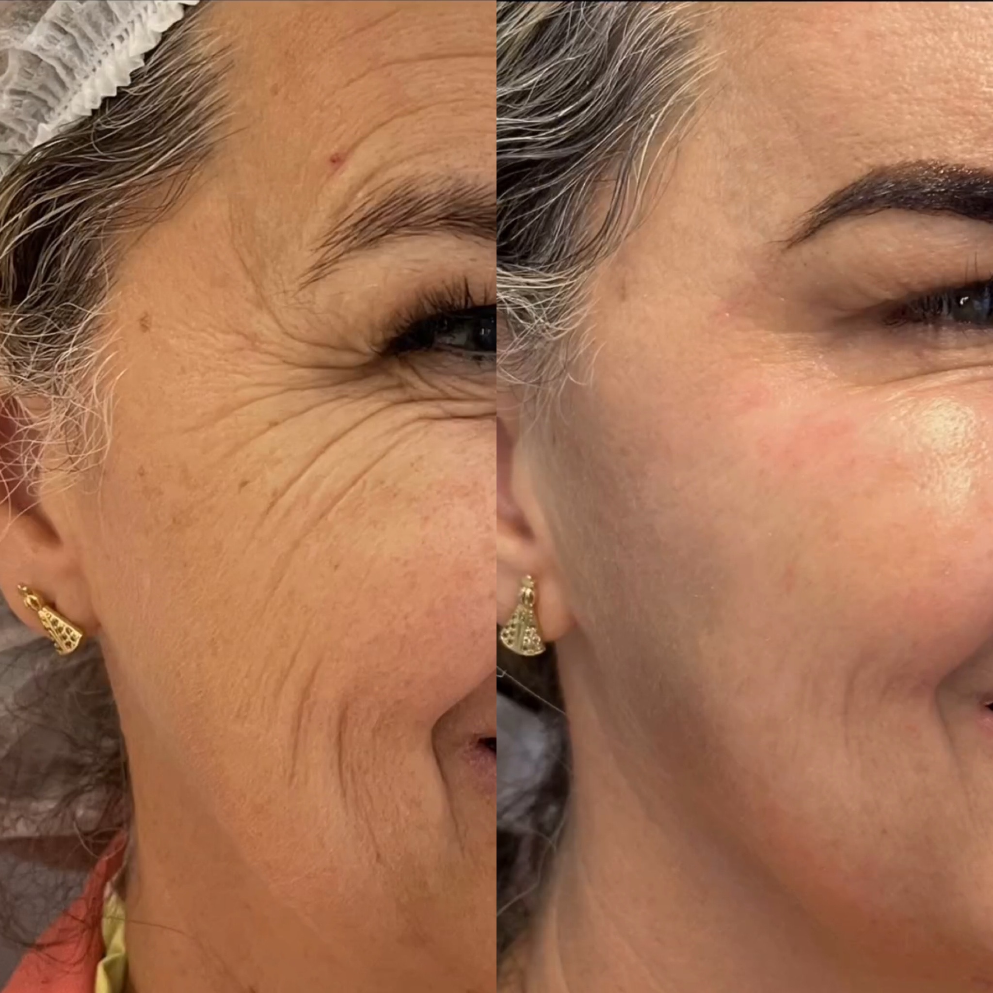 FAC3BB15-344D-4537-911A-5EE980217776