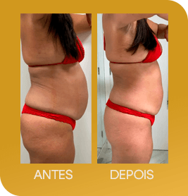 13ba931e-06_1000000000000000000028