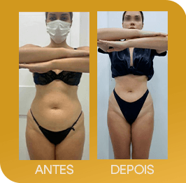 23499b2b-02_100000007e07b000000028