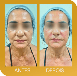 fe6f5322-01_1000000000000000000028